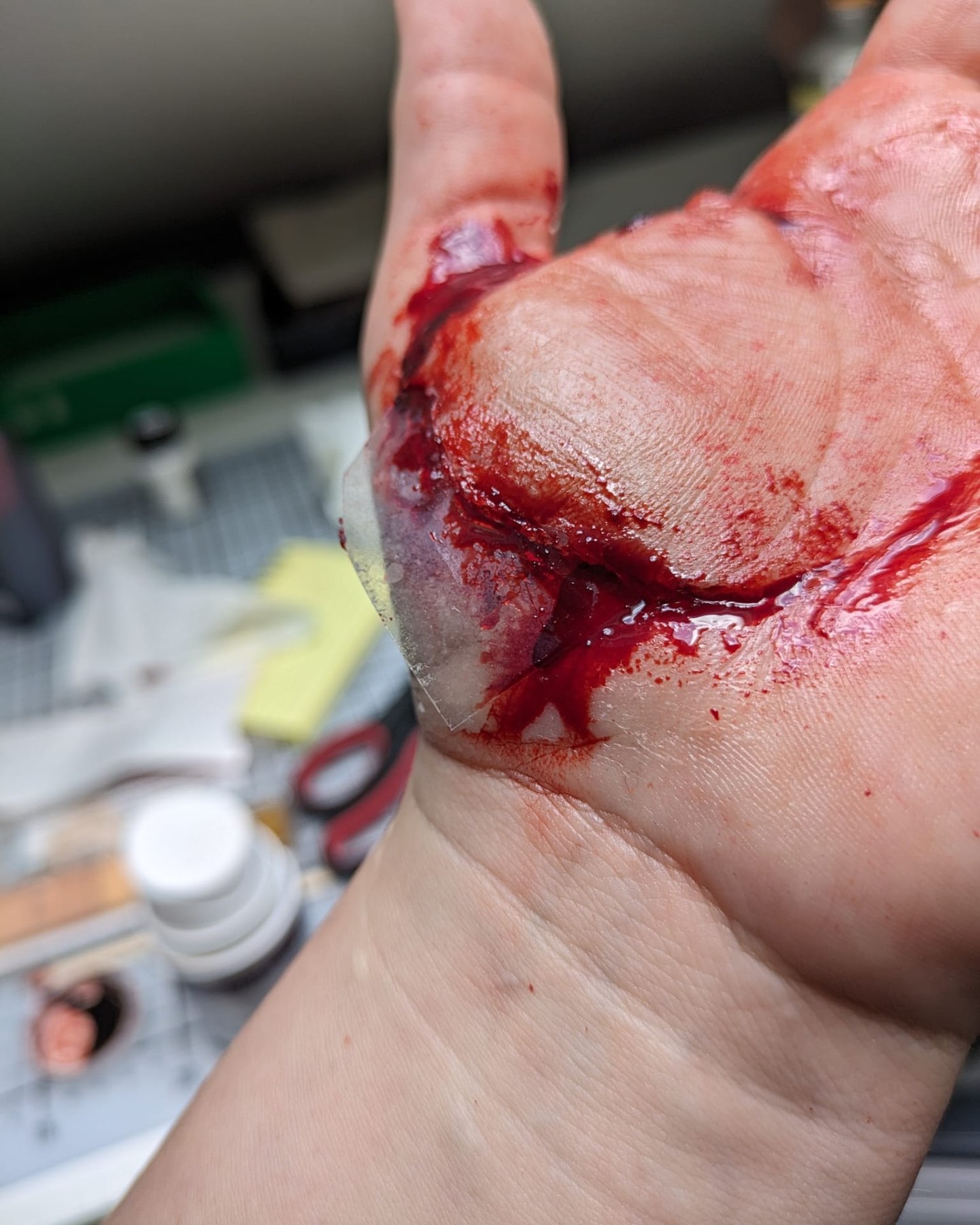 Schnittverletzung · Hand
